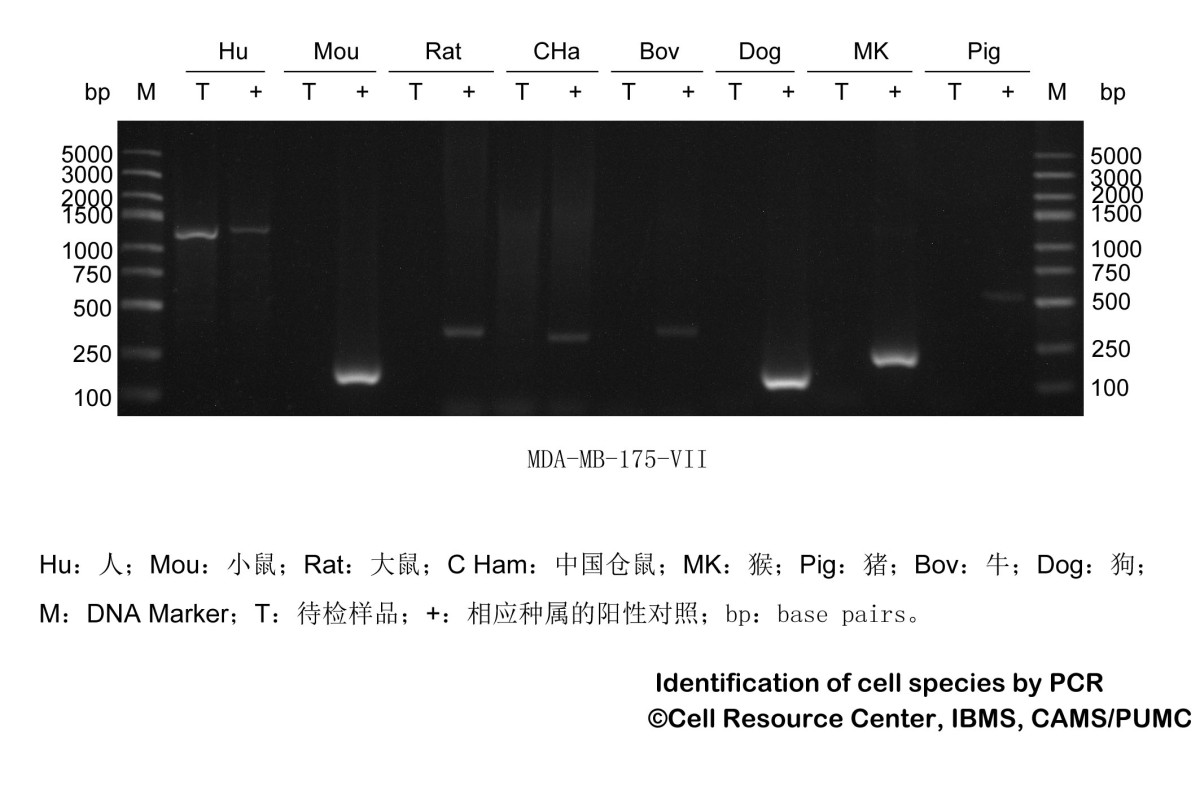 MDA-MB-175Ⅶ人乳腺导管癌细胞图?></a></div> <span style=