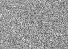 成人骨髓间充质干细胞图片