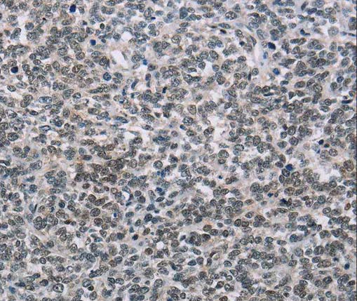 ATP酶钙离子转运蛋白PMCA3抗体图片