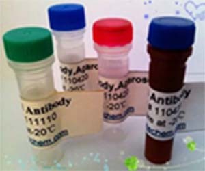 唾液富组蛋白3(HTN3)抗体图片