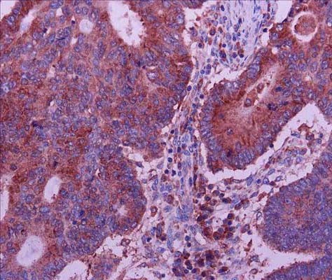 核小体组装蛋�?样蛋�?抗体图片