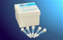 黄曲霉毒素M1免疫亲和?荧光)图片