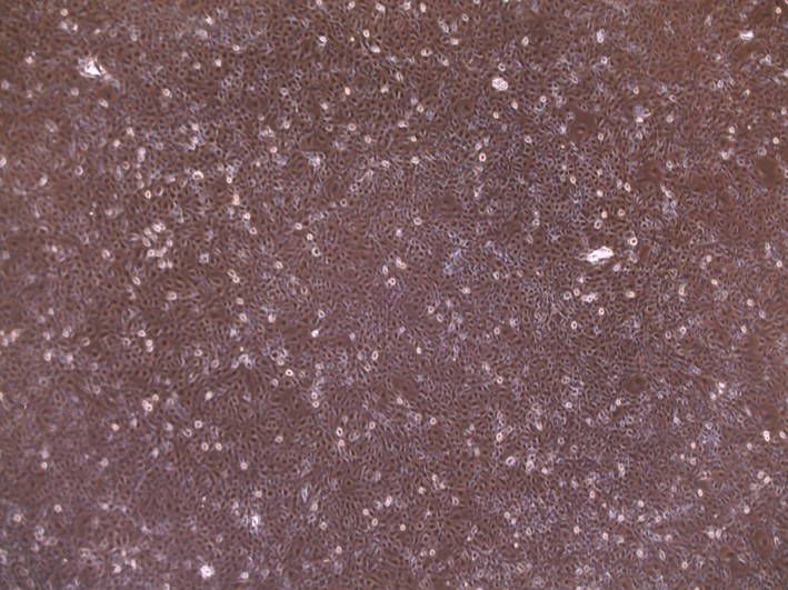 1.1B4人胰岛融合细胞图�?></a></div>    <span style=