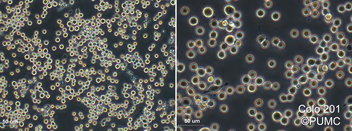 COLO 201人结直肠腺癌细胞图片