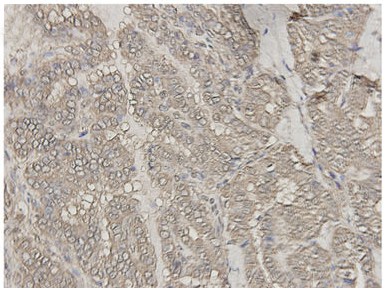 Anti BRAF(V600E)小鼠单抗图片