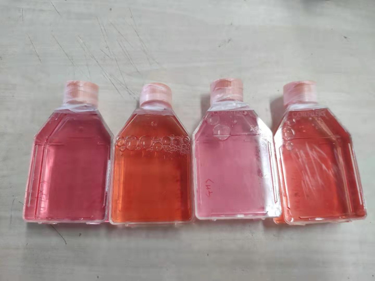 人原代脐静脉内皮细胞图片