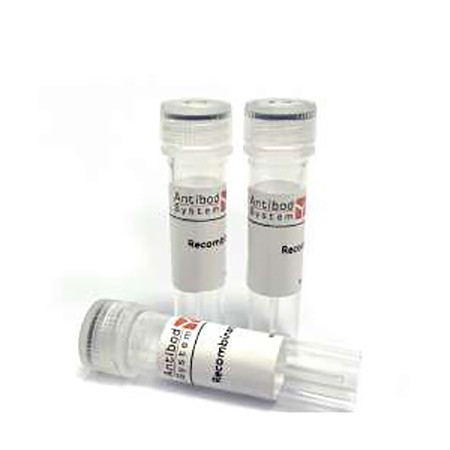 Anti-Human TSHR/LGR3 Antibody (M22)抗体图片