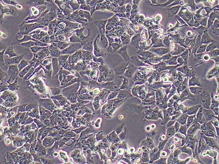 MHCC-97H人高转移性肝癌细�?STR鉴定正确)图片