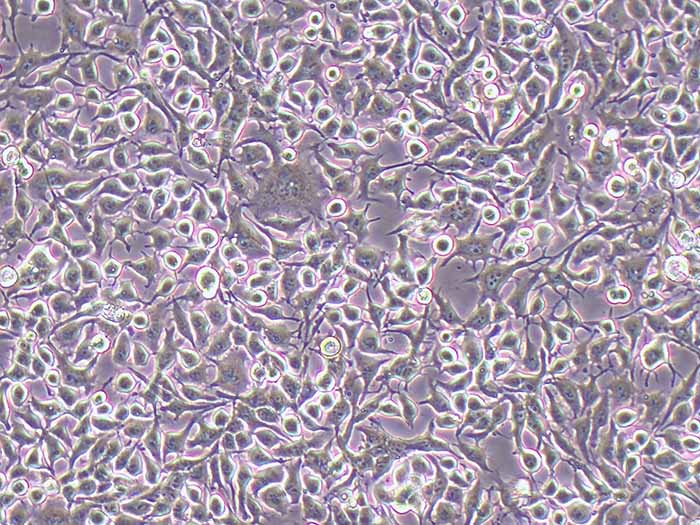 NCI-H3122人非小细胞肺癌细?STR鉴定正确)图片