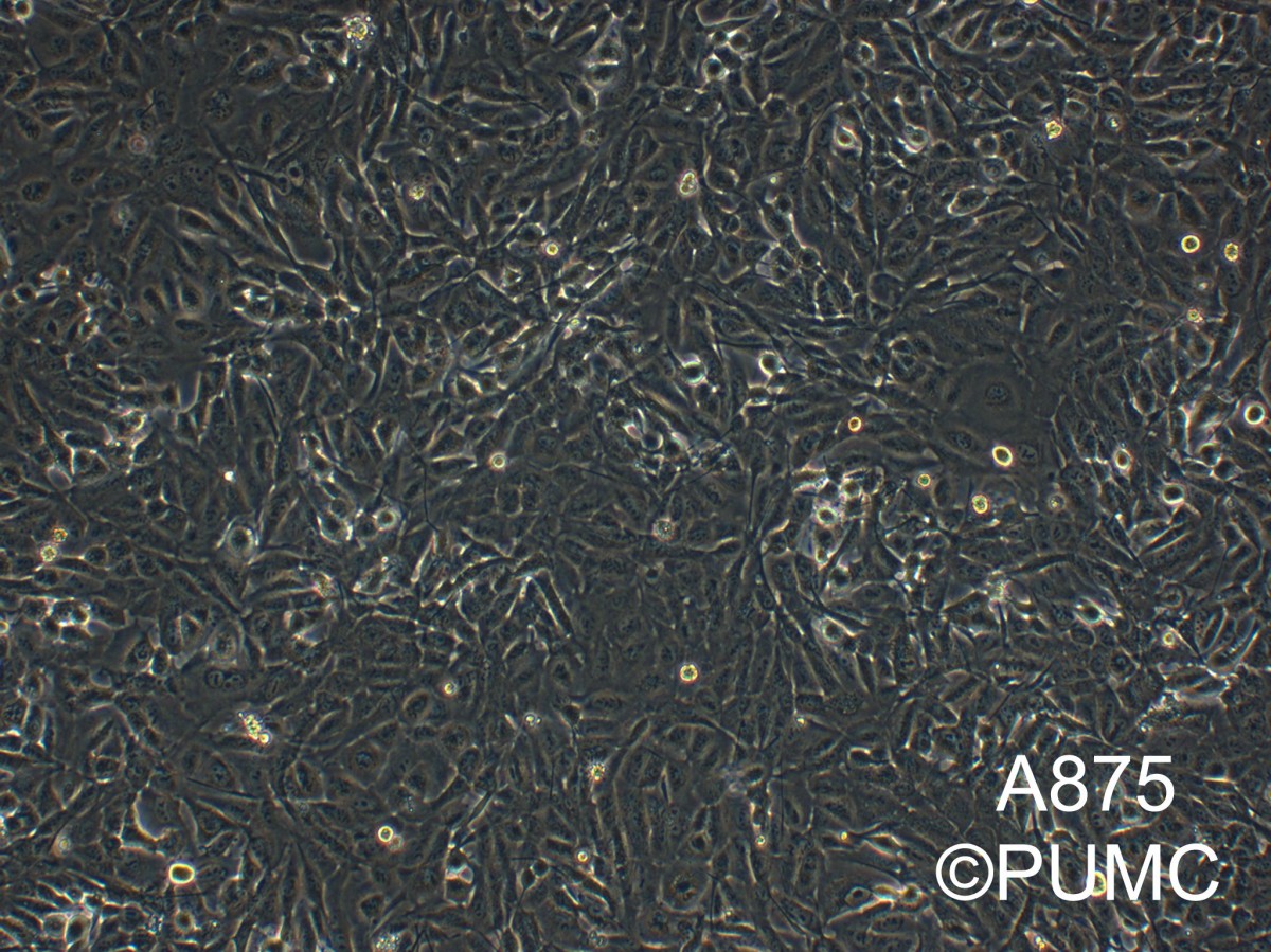 A875人黑色素瘤细胞图?></a></div>    <span style=