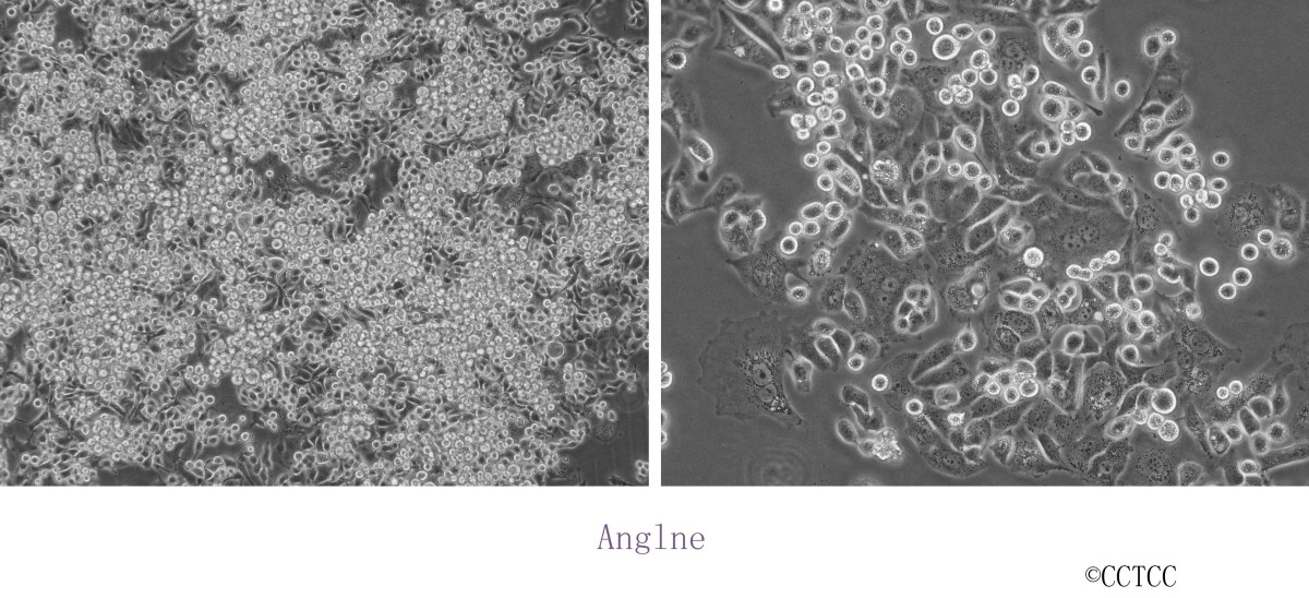 Anglne人卵巢癌细胞图片