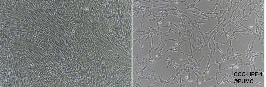 CCC-HPF-1人胚肺成纤维细胞图片