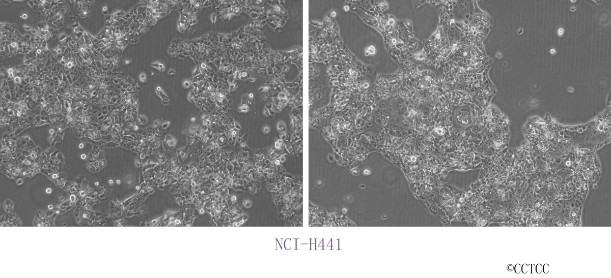NCI-H441人肺腺癌细胞图片
