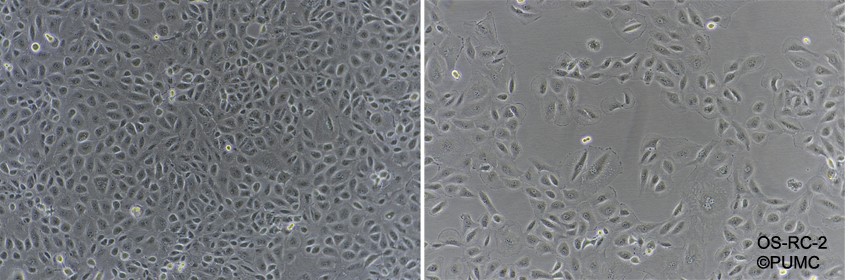 OS-RC-2人肾癌细胞图�?></a></div>    <span style=