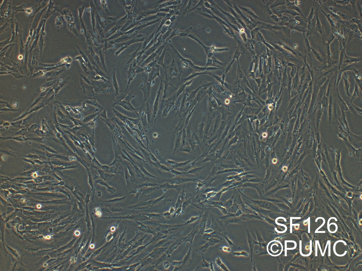 SF126人脑瘤细胞图�?></a></div>    <span style=