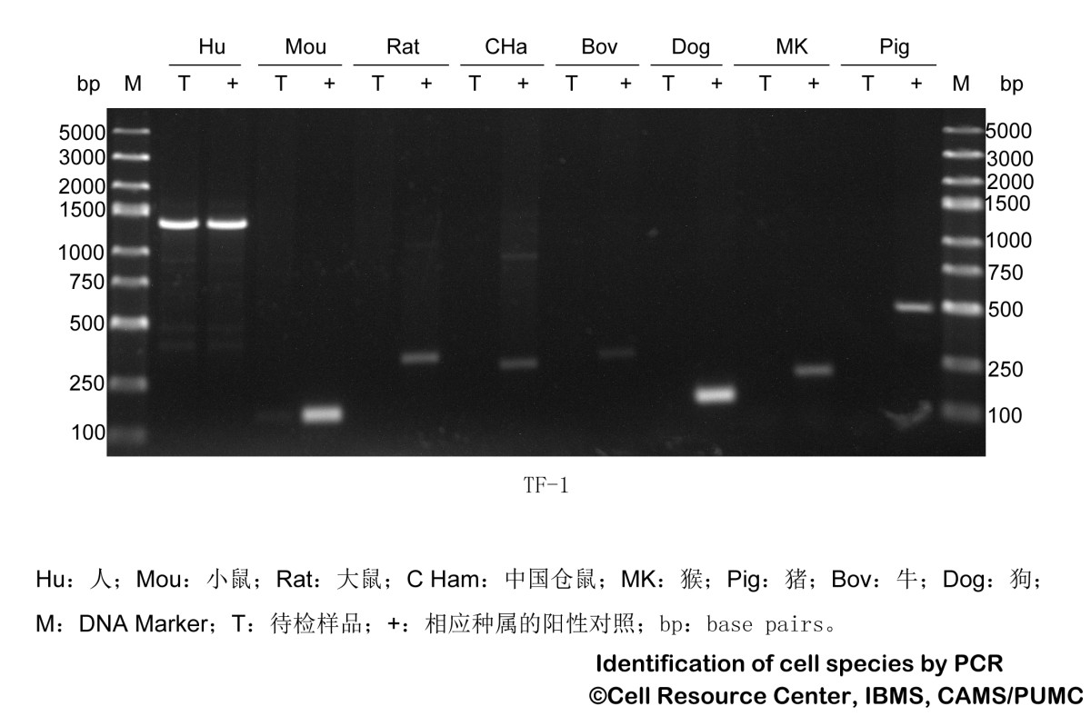 TF-1人红系白血病细胞图�?></a></div>    <span style=