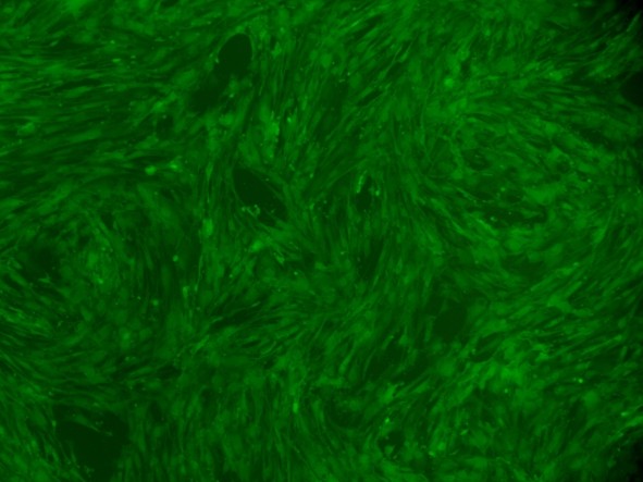 人脐血间充质干细胞-GFP图片