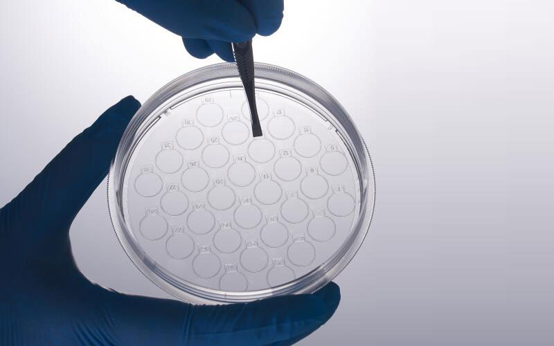 CellSLIP?细胞爬片培养皿图�?></a></div>    <span style=