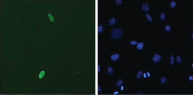 Monoclonal Anti-DUX4 antibody produced in mouse