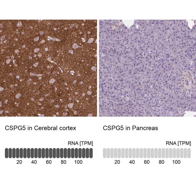 Anti-CSPG5 antibody produced in rabbit